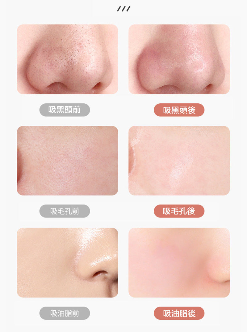【冷熱敷白色】家用便攜吸黑頭儀器黑頭粉刺導出清潔器毛孔潔面美容儀