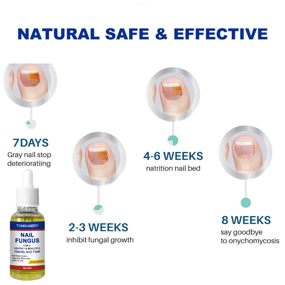 TONISABERY 指甲精華護理液去灰指甲30ml (6807577933274) EXP 06/08/2026