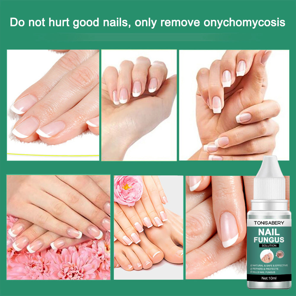 TONISABERY 灰甲液修護滋養液亮甲精華液10ml (6807577924272) EXP 05/06/2027