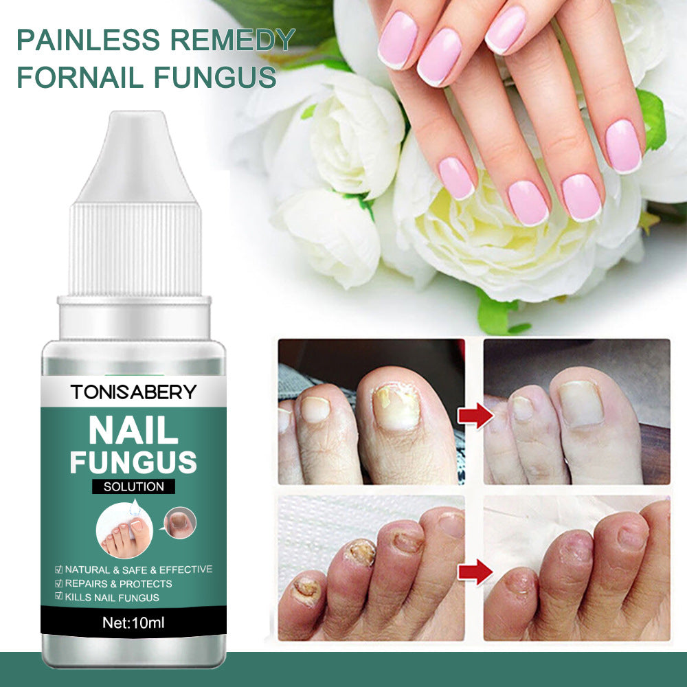 TONISABERY 灰甲液修護滋養液亮甲精華液10ml (6807577924272) EXP 05/06/2027