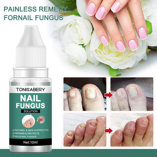 TONISABERY 灰甲液修護滋養液亮甲精華液10ml (6807577924272) EXP 05/06/2027